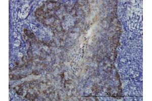 Immunoperoxidase of monoclonal antibody to KRT17 on formalin-fixed paraffin-embedded human tonsil. (KRT17 anticorps  (AA 1-432))