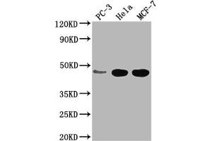 Western Blot Positive WB detected in: PC-3 whole cell lysate, Hela whole cell lysate, MCF-7 whole cell lysate All lanes: CCDC74B antibody at 1:2000 Secondary Goat polyclonal to rabbit IgG at 1/50000 dilution Predicted band size: 42, 36 kDa Observed band size: 42 kDa (CCDC74B anticorps  (AA 1-257))