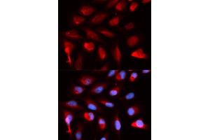 Immunofluorescence analysis of U2OS cells using PPARD antibody.
