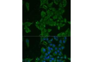 Immunofluorescence analysis of MCF7 cells using LGALS3BP Polyclonal Antibody (LGALS3BP anticorps)