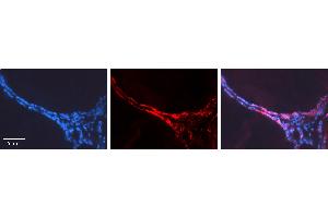 Rabbit Anti-CUX1 Antibody   Formalin Fixed Paraffin Embedded Tissue: Human Thyroid Gland Tissue Observed Staining: Cytoplasm Primary Antibody Concentration: 1:600 Other Working Concentrations: N/A Secondary Antibody: Donkey anti-Rabbit-Cy3 Secondary Antibody Concentration: 1:200 Magnification: 20X Exposure Time: 0.