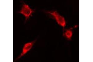 ABIN6266602 staining HepG2 cells by IF/ICC.