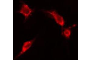 ABIN6266602 staining HepG2 cells by IF/ICC. (ENO2/NSE anticorps  (C-Term))
