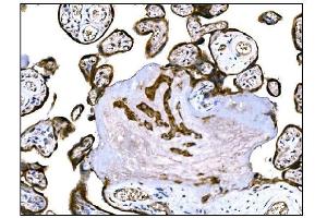 IHC analysis of IGF2R using anti-IGF2R antibody (ABIN7601705).