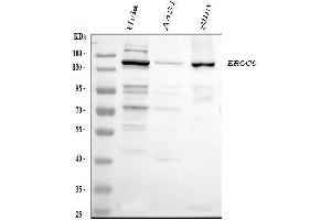 Western blot analysis of CSB using anti-CSB antibody (ABIN4886573).