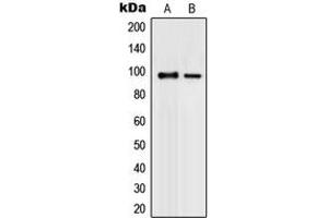 Western blot analysis of PML expression in K562 (A), COLO320 (B) whole cell lysates. (PML anticorps  (N-Term))