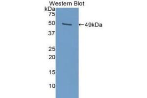 Western blot analysis of the recombinant protein. (PAI1 anticorps  (AA 25-402))