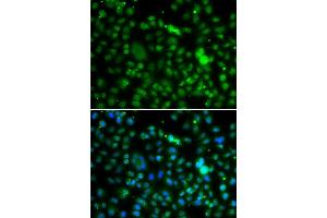 Immunofluorescence analysis of MCF7 cell using NSUN6 antibody. (NSUN6 anticorps)