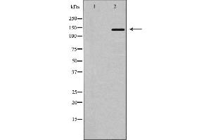 Western blot analysis of MDR1 using HT-29 whole cell lysates,The lane on the left is treated with the antigen-specific peptide. (ABCB1 anticorps  (Internal Region))