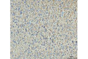 IHC analysis of MAP2 using anti-MAP2 antibody (ABIN7601483).