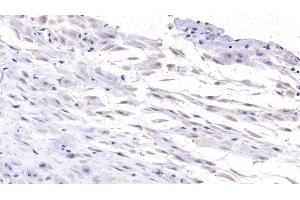 Detection of DSG3 in Human Placenta Tissue using Monoclonal Antibody to Desmoglein 3 (DSG3) (Desmoglein 3 anticorps  (AA 334-604))