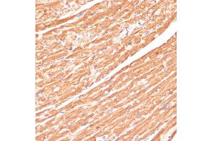 Immunohistochemistry of paraffin-embedded mouse heart using CYB5A antibody (ABIN6130832, ABIN6139296, ABIN6139297 and ABIN6221049) at dilution of 1:100 (40x lens). (CYB5A anticorps  (AA 1-100))