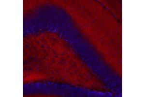 Indirect immunostaining of a PFA fixed mouse hippocampus section (dilution 1 : 200, red).
