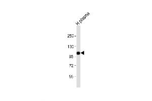 Western Blot at 1:1000 dilution + human plasma lysate Lysates/proteins at 20 ug per lane. (Complement Factor B anticorps  (AA 469-494))