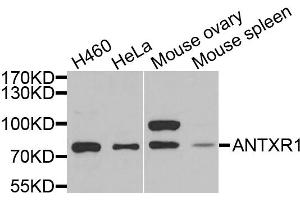 Western blot analysis of extracts of various cell lines, using ANTXR1 antibody. (ANTXR1 anticorps)