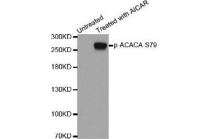 Western blot analysis of extracts from 293 cells using Phospho-ACACA-S79 antibody. (Acetyl-CoA Carboxylase alpha anticorps  (pSer79))