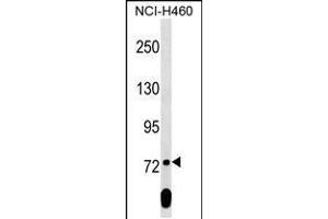 Western blot analysis in NCI-H460 cell line lysates (35ug/lane). (SCML2 anticorps  (AA 348-375))