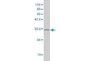 Western Blot detection against Immunogen (31.