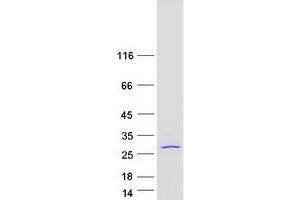 Eukaryotic Translation Initiation Factor 3 Subunit K (EIF3K) protein (Myc-DYKDDDDK Tag)