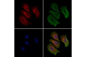 ABIN6261612 and ABIN6279424 staining Hela cells by IF/ICC. (ETAA1 anticorps  (Internal Region))