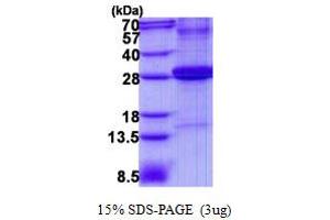 Image no. 1 for Complement Factor D (CFD) protein (His tag) (ABIN1098727) (Adipsin Protein (His tag))