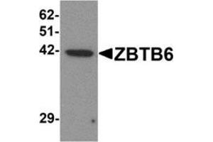 Western blot analysis of ZBTB6 in EL4 cell lysate with ZBTB6 antibody at 1 μg/ml. (ZBTB6 anticorps  (Center))