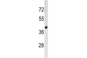 Western blot analysis of TROP2 antibody and HL-60 lysate.