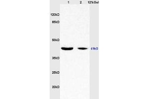 Lane 1: rat brain lysates Lane 2: human colon carcinoma lysates probed with Anti WNT7A Polyclonal Antibody, Unconjugated (ABIN719336) at 1:200 in 4 °C. (WNT7A anticorps  (AA 241-349))