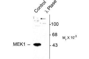 Image no. 1 for anti-Mitogen-Activated Protein Kinase Kinase 1 (MAP2K1) (pThr386) antibody (ABIN372666) (MEK1 anticorps  (pThr386))