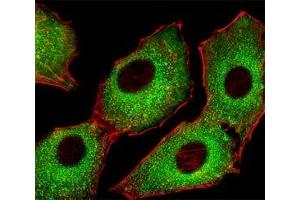 Fluorescent image of A549 cells stained with CDK5 antibody at 1:25 dilution.