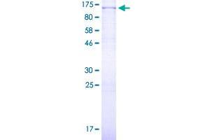 Image no. 1 for Forkhead Box M1 (FOXM1) (AA 1-748) protein (GST tag) (ABIN1354372)