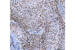 IHC analysis of SP1 using anti-SP1 antibody (ABIN7601559).