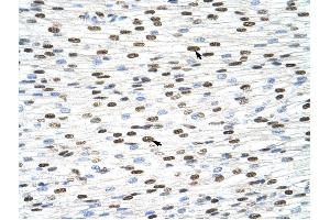 HNRPDL antibody was used for immunohistochemistry at a concentration of 4-8 ug/ml to stain Myocardial cells (arrows) in Human Heart.
