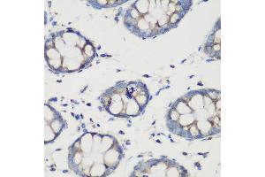 Immunohistochemistry of paraffin-embedded human colon using GLUD1 antibody at dilution of 1:200 (40x lens).