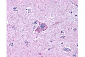 Anti-NPY5R antibody IHC of human brain, neurons and glia.