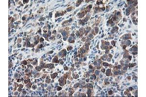 Image no. 5 for anti-Ribophorin 1 (RPN1) antibody (ABIN1500748) (RPN1 anticorps)