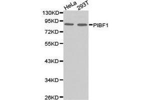 Western Blotting (WB) image for anti-Progesterone Immunomodulatory Binding Factor 1 (PIBF1) antibody (ABIN1874123) (PIBF1 anticorps)