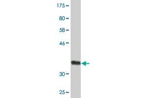 Western Blot detection against Immunogen (35.