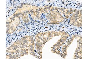 ABIN6265370 and ABIN6272981 at 1/100 staining Rat ovary tissue by IHC-P.