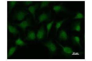 Immunostaining analysis in HeLa cells.