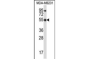Western blot analysis in MDA-MB231 cell line lysates (35ug/lane). (HCLS1 anticorps  (C-Term))