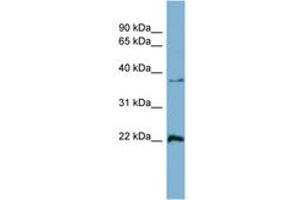 Image no. 1 for anti-RAN, Member RAS Oncogene Family (RAN) (AA 143-192) antibody (ABIN6741892) (RAN anticorps  (AA 143-192))