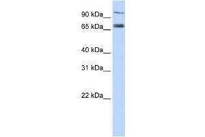 Western Blotting (WB) image for anti-Transporter 1, ATP-Binding Cassette, Sub-Family B (MDR/TAP) (TAP1) antibody (ABIN2458765) (TAP1 anticorps)