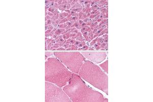anti-Nucleolar Protein 3 (Apoptosis Repressor with CARD Domain) (NOL3) (C-Term) antibody
