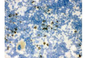 IHC analysis of Lipocalin 2 using anti-Lipocalin 2 antibody .