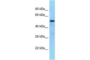 WB Suggested Anti-Gal3st4 Antibody Titration: 1. (GAL3ST4 anticorps  (N-Term))