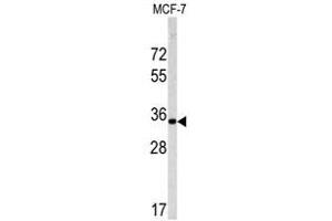 Image no. 1 for anti-Emerin (EMD) (C-Term) antibody (ABIN452956) (Emerin anticorps  (C-Term))