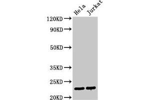 Western Blot Positive WB detected in: Hela whole cell lysate, Jurkat whole cell lysate All lanes: PTTG1 antibody at 3 μg/mL Secondary Goat polyclonal to rabbit IgG at 1/50000 dilution Predicted band size: 23 kDa Observed band size: 23 kDa (PTTG1 anticorps  (AA 2-202))