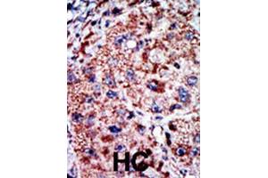 Immunohistochemistry (IHC) image for anti-Phosphofructokinase, Liver (PFKL) antibody (ABIN3003704) (PFKL anticorps)