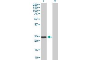 Western Blot analysis of ARHGDIA expression in transfected 293T cell line by ARHGDIA MaxPab polyclonal antibody.